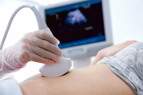 Ultrasound service image
